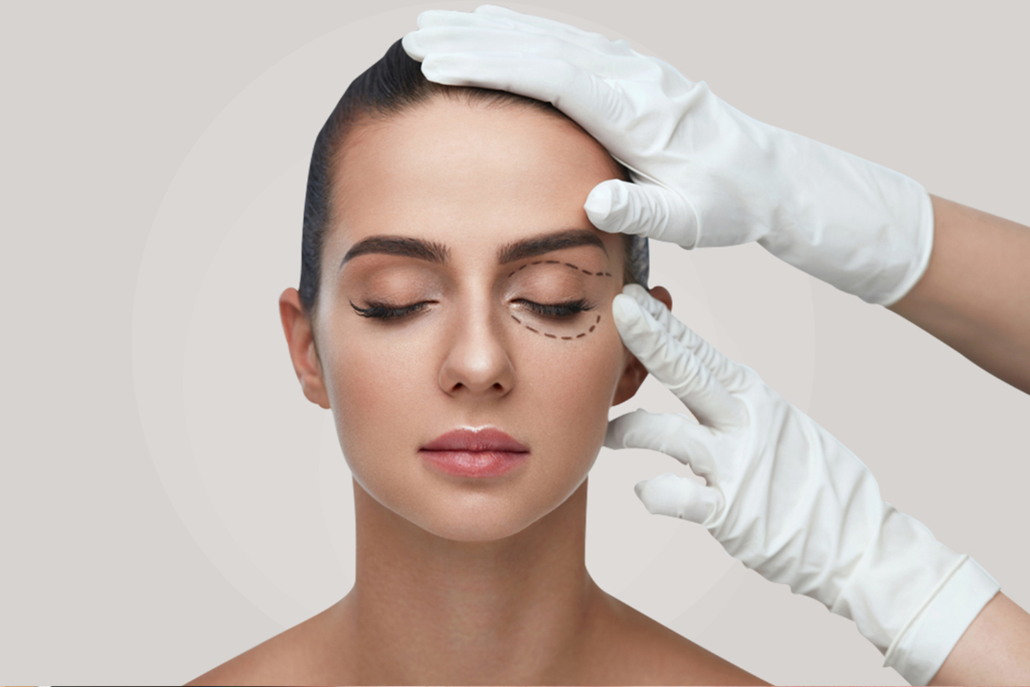 Eyelid Esthetic (Blepharoplasty)